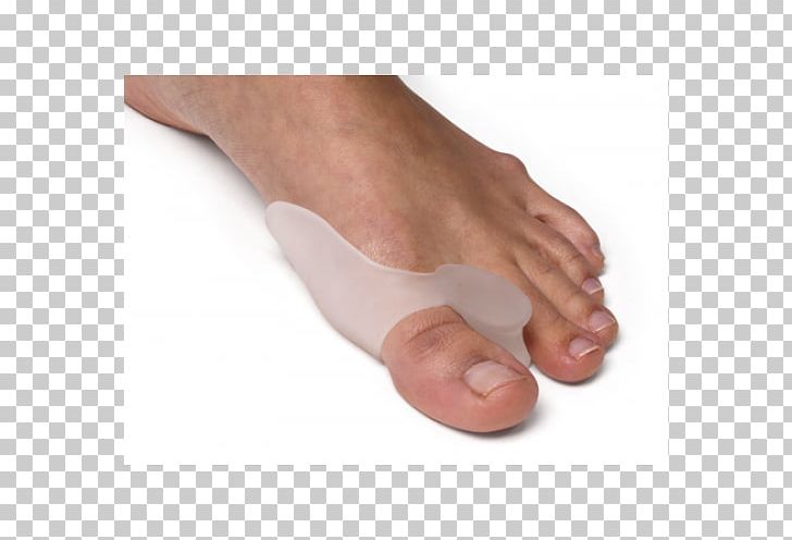 Bunion Toe Hallux Rigidus Foot PNG, Clipart, Bone, Bunion, Bunionectomy, Corn, Fifth Toe Free PNG Download