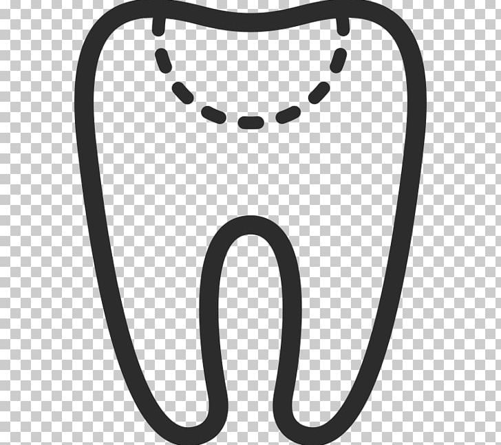 Human Tooth Tooth Decay Dentistry Smile PNG, Clipart, Amalgam, Black, Black And White, Body Jewelry, Caries Free PNG Download