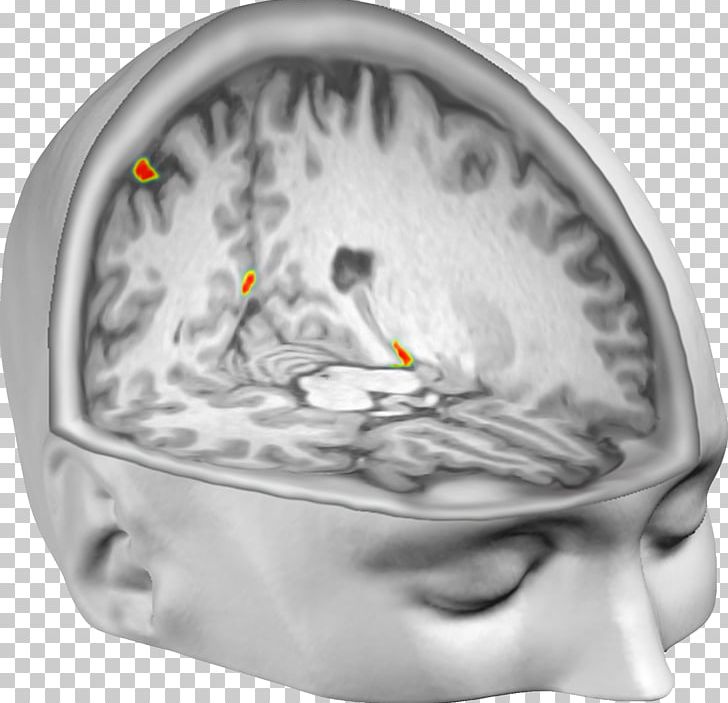Out-of-body Experience Brain Neuroscience Neuroimaging PNG, Clipart, Astral Projection, Brain, Experience, Experiment, Human Body Free PNG Download