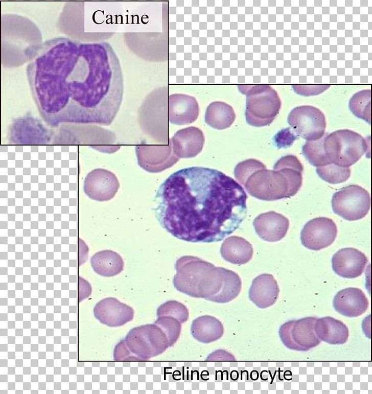 Monocyte Hematology Monocytosis Blood Dog PNG, Clipart, Blood, Cancer, Cat, Dog, Ehrlichiosis Free PNG Download