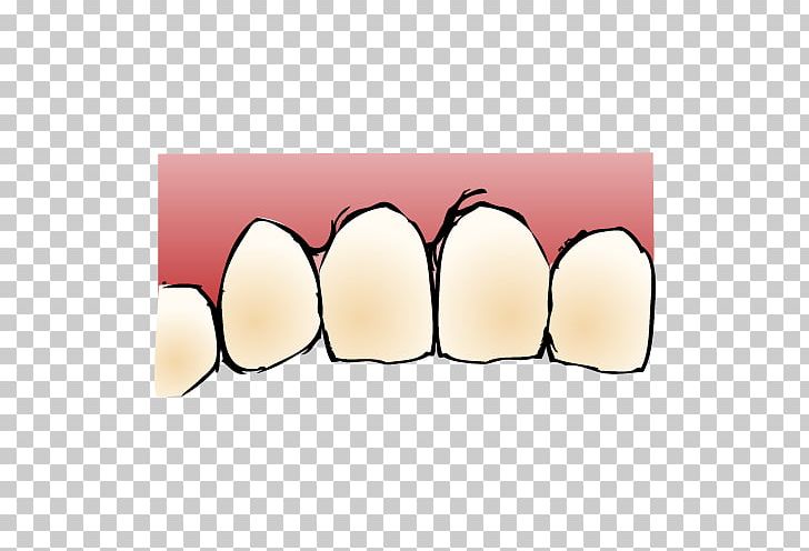 Tooth いがらし歯科クリニック Dentist Dental Implant PNG, Clipart, City, Dental Implant, Dentist, Dentistry, Implant Free PNG Download