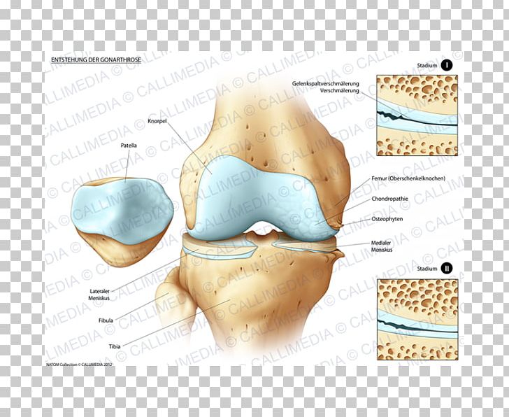 Tibia Knee Pain Bone Fracture Joint PNG, Clipart, Bone, Bone Fracture, Disease, Ear, Femur Free PNG Download