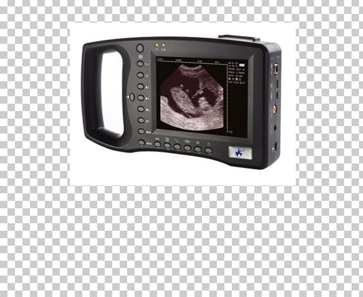 Ultrasound Ultrasonography Medicine Medical Diagnosis Doppler Echocardiography PNG, Clipart, 3d Ultrasound, Camer, Digital Camera, Display Device, Doppler Echocardiography Free PNG Download