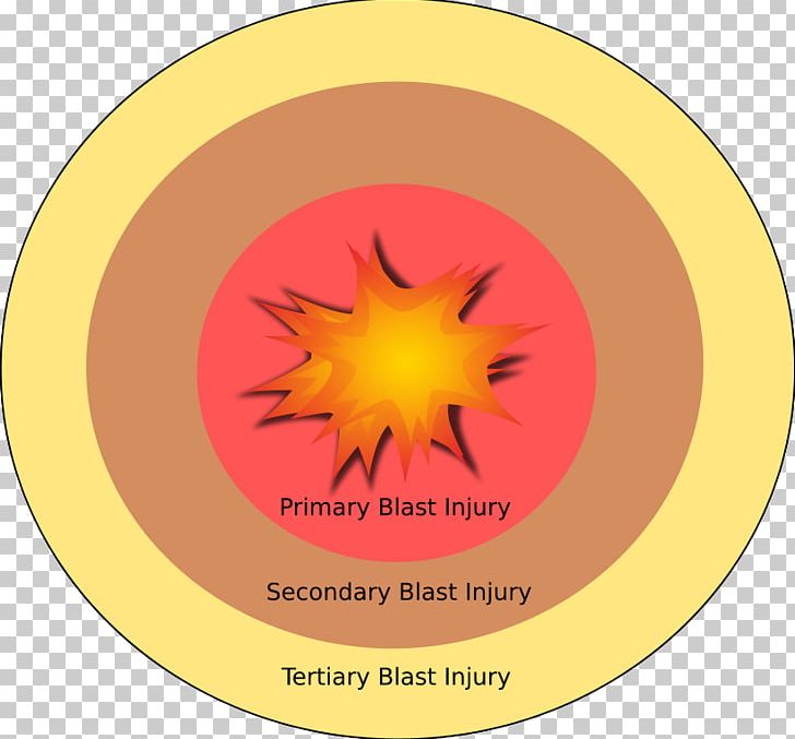 Explosion Blast Injury Explosive Material Blast Wave PNG, Clipart, Anatomy, Blast Injury, Blast Wave, Bomb, Circle Free PNG Download