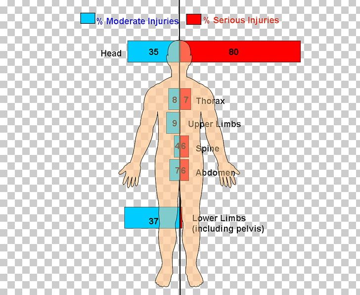 Car Injury Pedestrian Safety Through Vehicle Design Traffic Collision PNG, Clipart, Abdomen, Angle, Area, Arm, Bone Fracture Free PNG Download