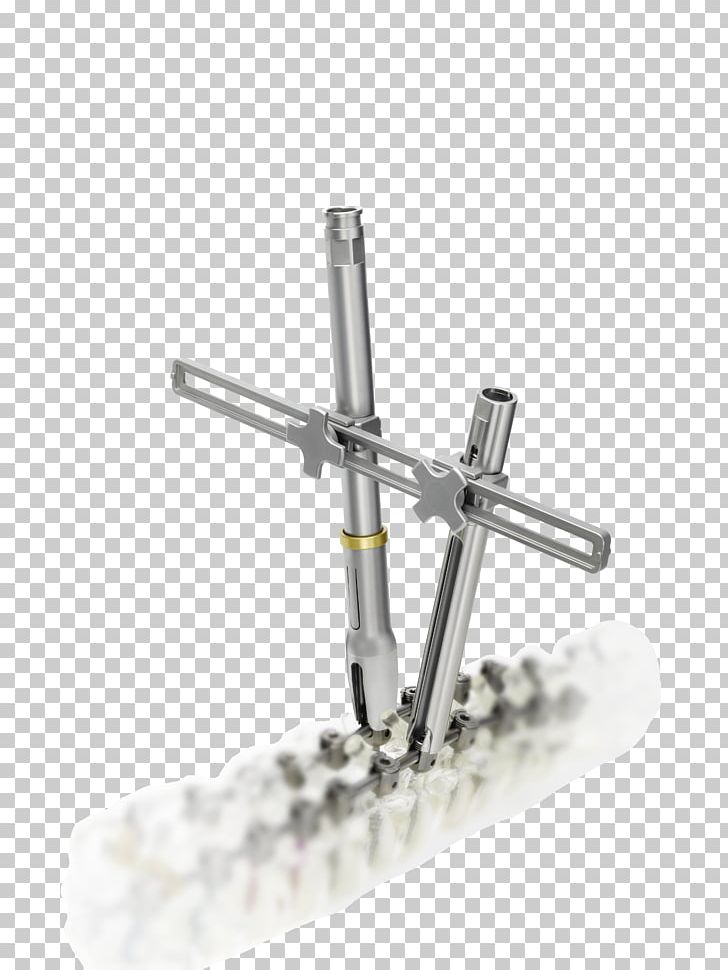 Metal Angle PNG, Clipart, Angle, Art, Metal, Spine Surgeon Free PNG Download