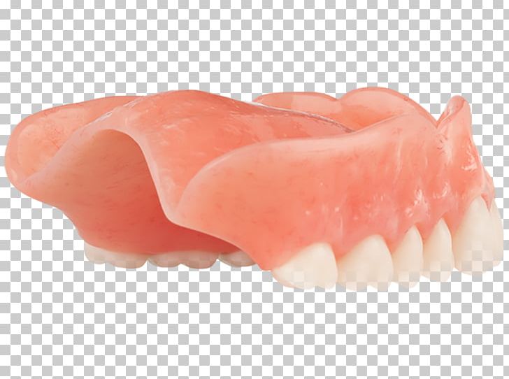 Tooth Dentures PNG, Clipart, Aspen Dental, Dentures, Jaw, Mouth, Others Free PNG Download