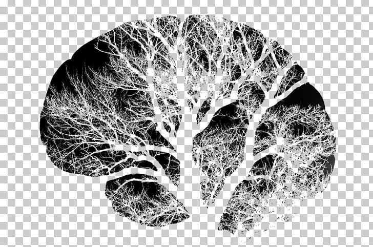 Human Brain Neuron Nervous System PNG, Clipart, Black And White, Brain, Clip Art, Human Body, Human Brain Free PNG Download
