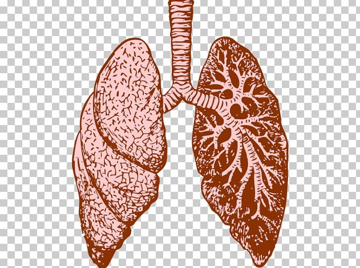 Lung Cystic Fibrosis Chronic Obstructive Pulmonary Disease Breathing PNG, Clipart, 2 B, Breathing, Computed Tomography Angiography, Cystic Fibrosis, Fibrosis Free PNG Download