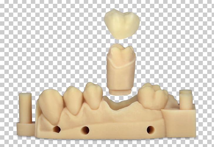 Dentistry EnvisionTEC 3D Printing Crown PNG, Clipart, 3d Printing, Booth, Crown, Dent, Dental Free PNG Download