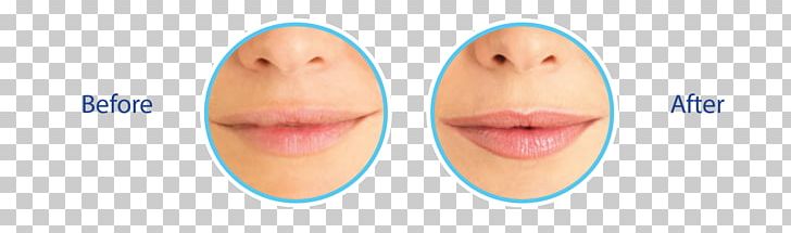 Thumb Lip Chin Cheek Mouth PNG, Clipart, Cheek, Chin, Closeup, Ear, Eyelash Free PNG Download