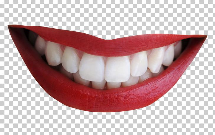 Smile Tooth Mouth PNG, Clipart, Computer Icons, Dental Braces, Free, Human Tooth, Jaw Free PNG Download