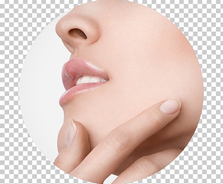 Melasma Forehead Cream Cheek Mouth PNG, Clipart, Alessi, Beauty, Cheek, Chin, Closeup Free PNG Download