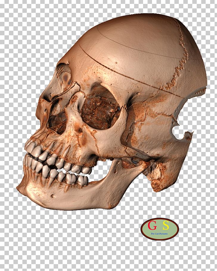 Human Skeleton Skull Snout Turtle PNG, Clipart, Algorithm, Bone, Fantasy, Head, Homo Sapiens Free PNG Download