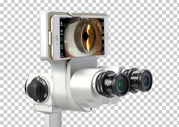 Slit Lamp Ophthalmology Anterior Segment Of Eyeball Ocular Tonometry PNG, Clipart, Anterior Segment Of Eyeball, Camera, Camera Accessory, Camera Lens, Fundus Free PNG Download