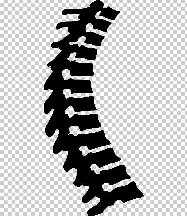Herr Dr. Med. Wolfgang Martin Scalable Graphics Vertebral Column Computer Icons PNG, Clipart, Black, Black And White, Cdr, Computer Icons, Encapsulated Postscript Free PNG Download