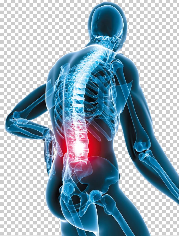 Low Back Pain Neck Pain Oxycodone Human Back PNG, Clipart, Back Pain, Disease, Electric Blue, Human Back, Injury Free PNG Download