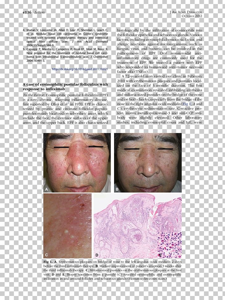 Chin Cheek Face Forehead Jaw PNG, Clipart, Case, Cheek, Chin, Closeup, Crohns Disease Free PNG Download