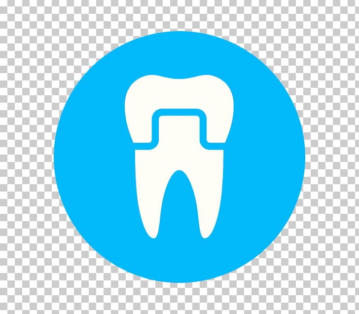 Crown Cosmetic Dentistry Dental Implant PNG, Clipart, Angle, Aqua, Area, Azure, Blue Free PNG Download