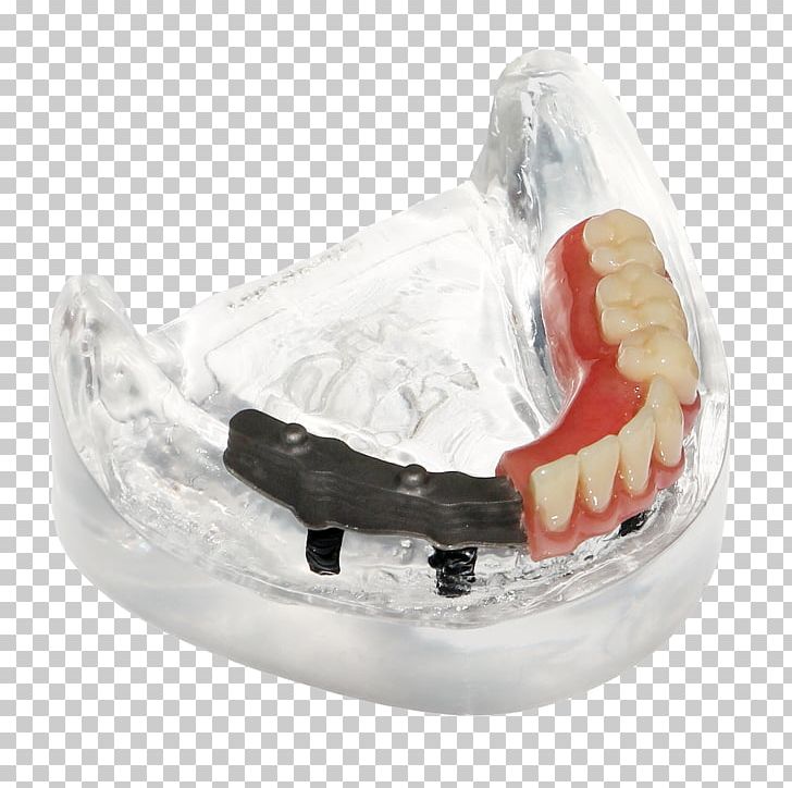 Dentures Tooth Made PNG, Clipart, Core, Core Product, Dentures, Digital Data, Fix Free PNG Download