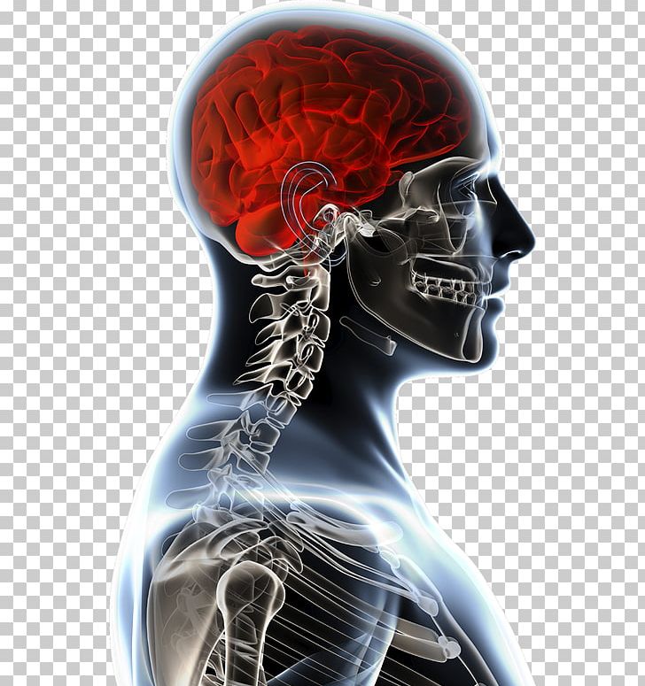Brain Tumor Anatomy Anatomia Y Fisiologia Physiology PNG, Clipart, Anatomia Y Fisiologia, Anatomy, Brain, Brain Tumor, Disease Free PNG Download