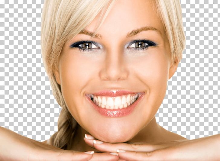 Cosmetic Dentistry Dental Implant Gums PNG, Clipart, Blond, Braces, Brown Hair, Cheek, Chin Free PNG Download