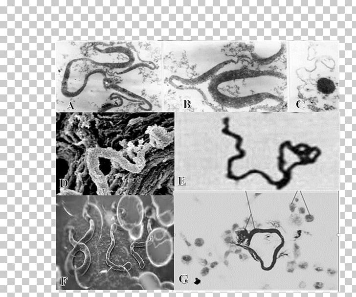 L-form Bacteria Microscope Virus Tuberculosis PNG, Clipart, Bacteria, Black And White, Cell, Cell Wall, Disease Free PNG Download