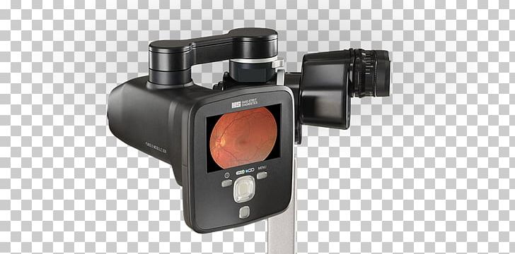 Haag-Streit Holding Slit Lamp Fundus Photography Retina PNG, Clipart, Camera, Camera Accessory, Fundus, Fundus Photography, Haagstreit Holding Free PNG Download