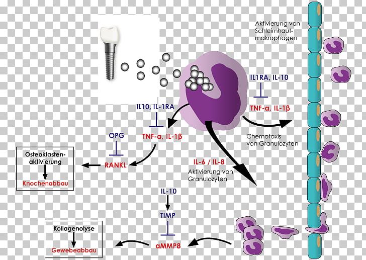 Inflammation Cytokine Peri-implantitis Immune System Interleukin PNG, Clipart, Audio, Brand, Communication, Cytokine, Diagram Free PNG Download