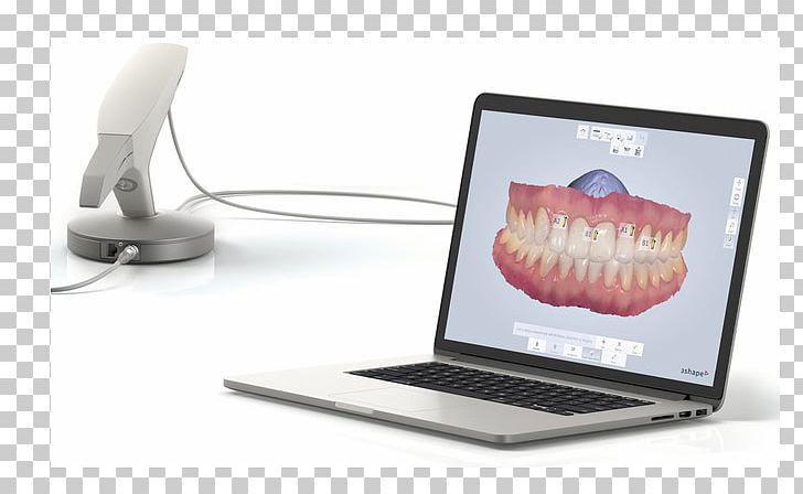 3Shape Scanner Dentistry 3D Scanner PNG, Clipart, 3 Shape, 3d Scanner, 3shape, Computer Monitor Accessory, Cone Beam Computed Tomography Free PNG Download