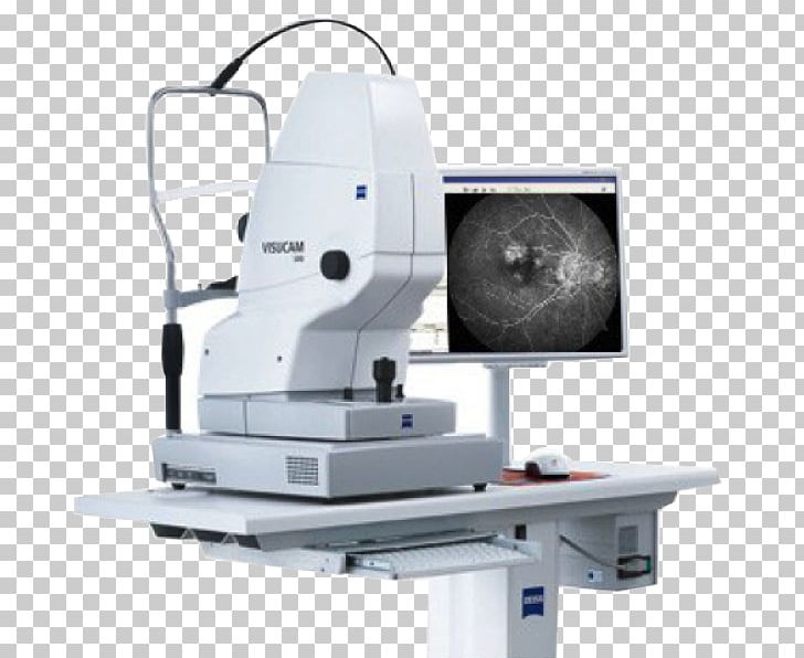 Fundus Photography Carl Zeiss AG Optical Coherence Tomography Mydriasis PNG, Clipart, Camera, Carl Zeiss, Carl Zeiss Ag, Eye, Fundus Free PNG Download