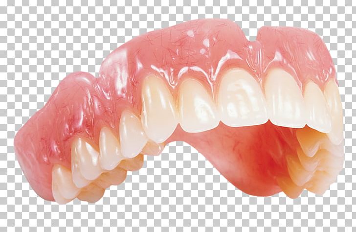 Dentures Dental Laboratory Dentsply Sirona Dentistry PNG, Clipart, Acrylic Resin, Dental Laboratory, Dentist, Dentistry, Dentsply Sirona Free PNG Download