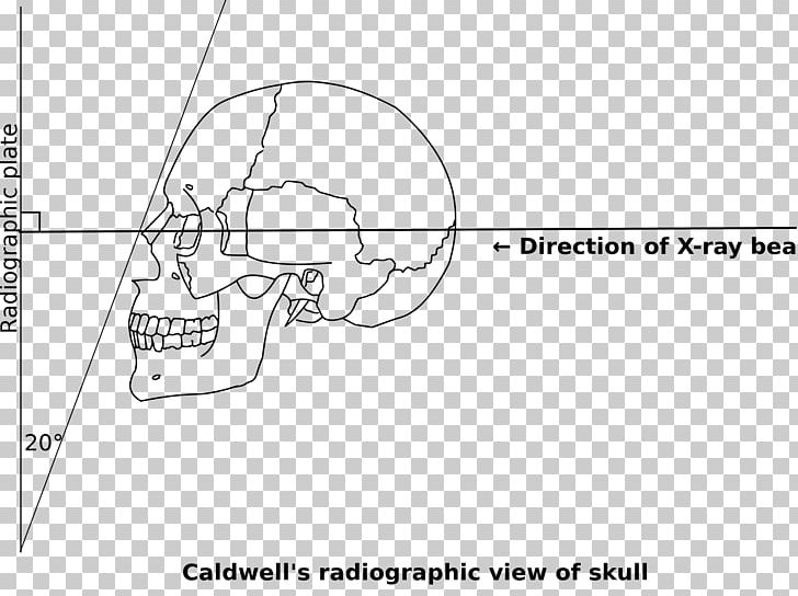 /m/02csf Ear Document Drawing PNG, Clipart, Acromegaly, Angle, Area, Black And White, Brand Free PNG Download