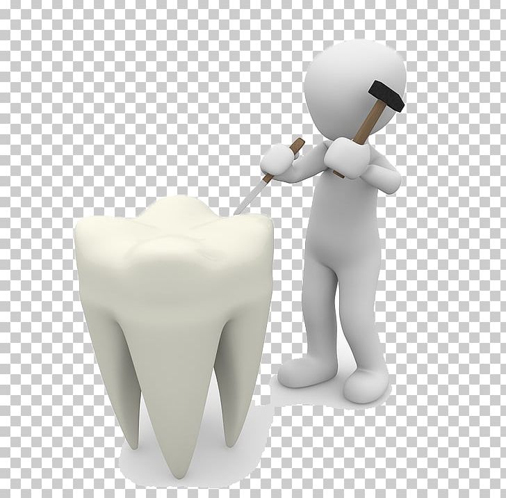 Tooth Pathology Dentistry Tooth Enamel Human Tooth PNG, Clipart, Auto Repair, Car Repair, Clean, Computer Repair, Cosmetic Dentist Free PNG Download