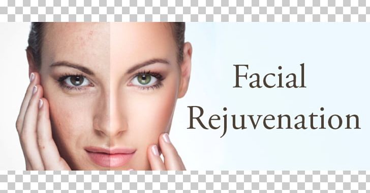 Facial Rejuvenation Surgery Photorejuvenation PNG, Clipart, Brand, Cheek, Chin, Cosmetics, Day Spa Free PNG Download
