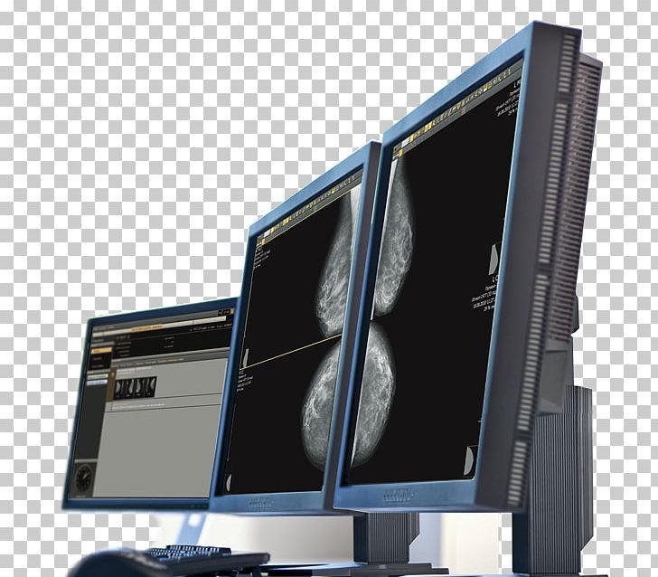 Computer Monitors Computer Hardware Doctor Of Medicine Health Technology PNG, Clipart, Computer, Computer Hardware, Computer Monitor Accessory, Computer Network, Easily Ltd Free PNG Download