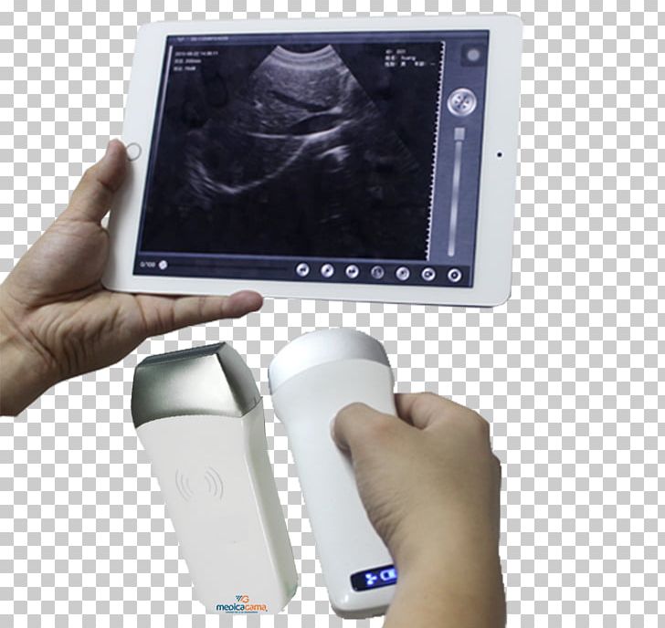 Mobile Phones Ultrasonography Ultrasound Medicine Health PNG, Clipart, Agama, Cause, Communication Device, Disease, Electronic Device Free PNG Download