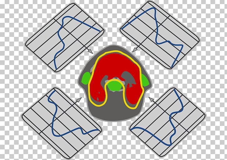 Magnetic Resonance Imaging Computed Tomography Computer Icons PNG, Clipart, Angle, Area, Chest Radiograph, Computed Tomography, Computer Icons Free PNG Download