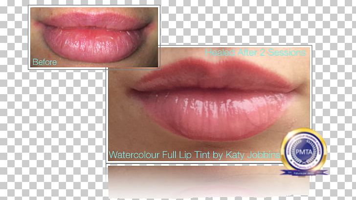 Lip Gloss Lip Augmentation Permanent Makeup Lip Stain PNG, Clipart, Cheek, Color, Cosmetics, Dermis, Eyelash Free PNG Download