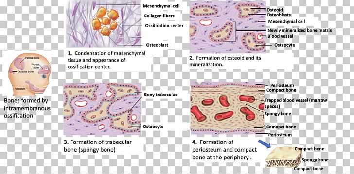 Intramembranous Ossification Parietal Bone Skull PNG, Clipart, Anatomy, Area, Bone, Exempli Gratia, Fantasy Free PNG Download