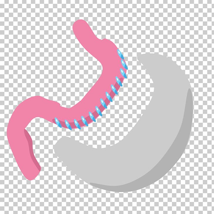 Sleeve Gastrectomy Gastric Bypass Surgery Bariatric Surgery PNG, Clipart, Bariatric Surgery, Duodenal Switch, Gastrectomy, Hand, Jaw Free PNG Download