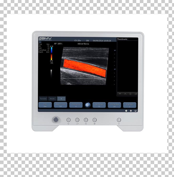 Display Device Ultrasonography Laptop Computer Monitors Ultrasound PNG, Clipart, Computer Hardware, Computer Monitors, Cordless, Display Device, Electronic Device Free PNG Download