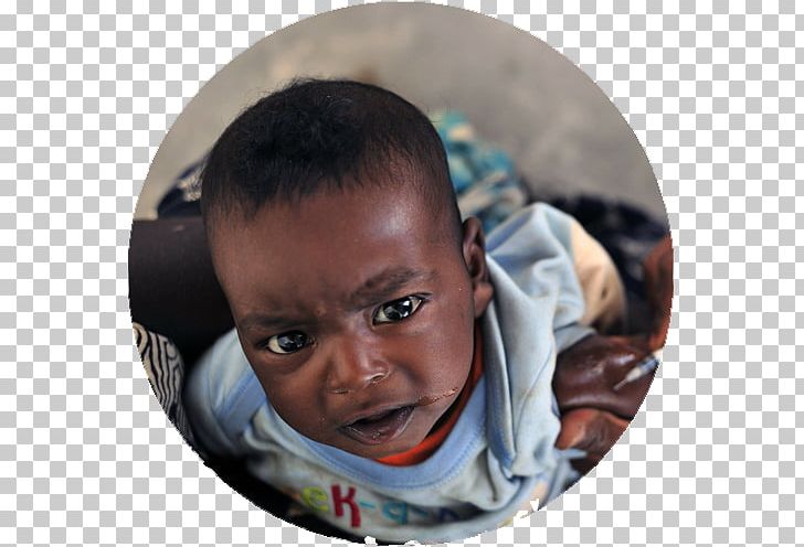 Malaria Vaccine Immunization Smallpox Vaccine Rubella Vaccine PNG, Clipart, Bcg Vaccine, Chickenpox, Child, Forehead, Immunization Free PNG Download