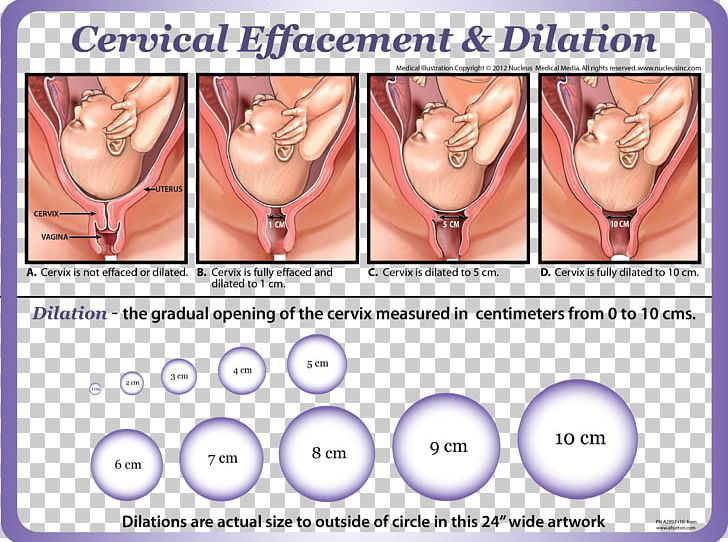 Cervical Effacement Cervical Dilation Cervix Childbirth PNG, Clipart, Cervical Dilation, Cervical Effacement, Cervix, Cheek, Childbirth Free PNG Download