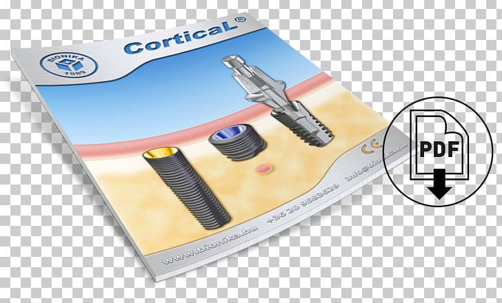 Cortical Implant Bionics System PDF PNG, Clipart, Average, Bionics, Bone, Brand, Cerebral Cortex Free PNG Download