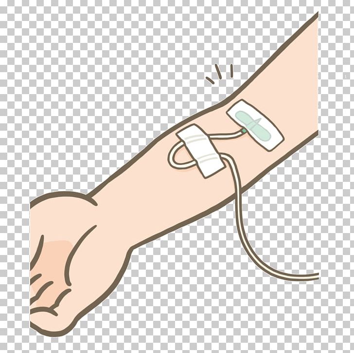 Intravenous Therapy Hypodermic Needle Injection Intraveineuse Syringe Driver PNG, Clipart, Arm, Ear, Finger, Hand, Health Care Free PNG Download