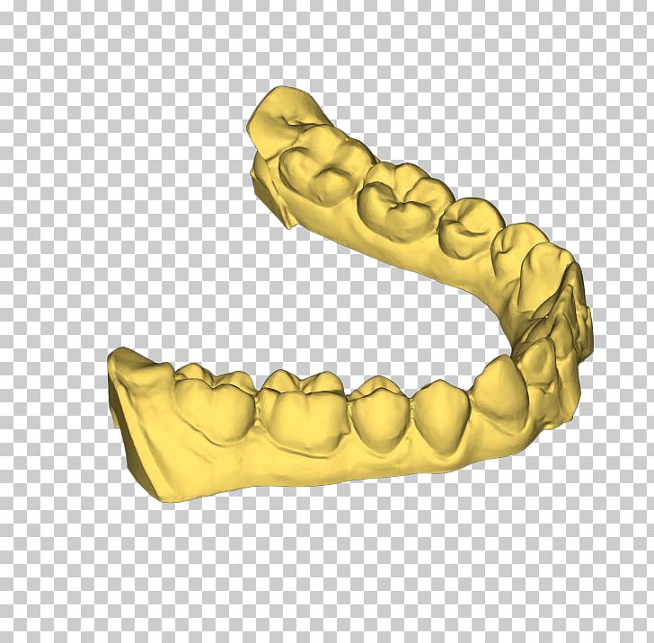 3D Printing Printer Dental Arch Dentistry PNG, Clipart, 3d Computer Graphics, 3d Dental Treatment For Toothache, 3d Printing, Arch, Dental Arch Free PNG Download