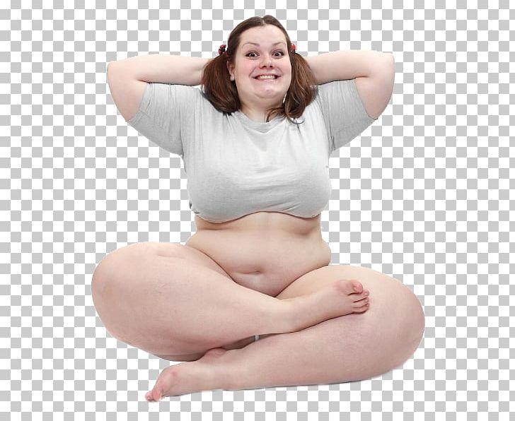 Obesity Overweight Adolescence Girl Woman PNG, Clipart, Abdomen, Adipose Tissue, Adolescence, Arm, Beauty Free PNG Download