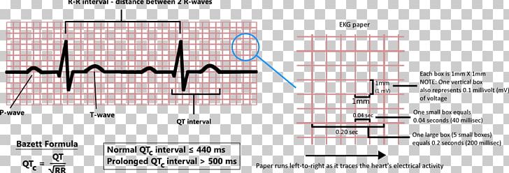 QT Interval Diagram Point Health Care Angle PNG, Clipart, Angle, Diagram, Formula, Health Care, Interval Free PNG Download