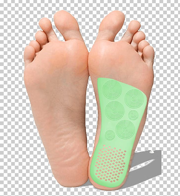 Podalgia Diabetic Foot Flat Feet Skin Ulcer PNG, Clipart,  Free PNG Download